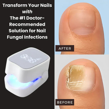 DropVibeHub™ - Nail Fungus Laser Device